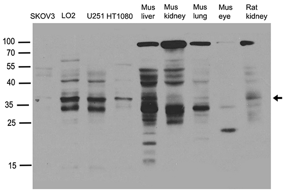 SMUG1 Antibody - Western blot analysis of extracts. (35ug) from different cell lines or tissues by using anti-SMUG1 rabbit polyclonal antibody .