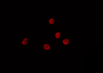 SMUG1 Antibody - Staining HeLa cells by IF/ICC. The samples were fixed with PFA and permeabilized in 0.1% Triton X-100, then blocked in 10% serum for 45 min at 25°C. The primary antibody was diluted at 1:200 and incubated with the sample for 1 hour at 37°C. An Alexa Fluor 594 conjugated goat anti-rabbit IgG (H+L) Ab, diluted at 1/600, was used as the secondary antibody.