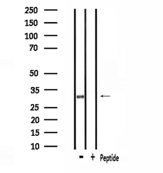 SMUG1 Antibody - Western blot analysis of extracts of rat spleen using SMUG1 antibody.