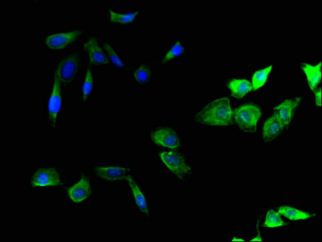 SMURF1 Antibody - Immunofluorescent analysis of Hela cells using SMURF1 Antibody at a dilution of 1:100 and Alexa Fluor 488-congugated AffiniPure Goat Anti-Rabbit IgG(H+L)