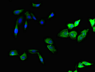 SMURF1 Antibody - Immunofluorescent analysis of Hela cells using SMURF1 Antibody at dilution of 1:100 and Alexa Fluor 488-congugated AffiniPure Goat Anti-Rabbit IgG(H+L)