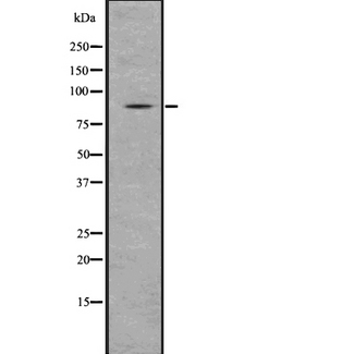 SMURF1 Antibody - Western blot analysis of Smurf using COLO205 whole lysates.