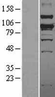 SMURF1 Protein - Western validation with an anti-DDK antibody * L: Control HEK293 lysate R: Over-expression lysate