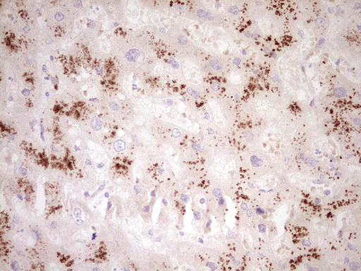 SMURF2 Antibody - Immunohistochemical staining of paraffin-embedded Human liver tissue within the normal limits using anti-SMURF2 mouse monoclonal antibody. (Heat-induced epitope retrieval by 1 mM EDTA in 10mM Tris, pH8.5, 120C for 3min,