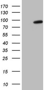 SMURF2 Antibody - HEK293T cells were transfected with the pCMV6-ENTRY control. (Left lane) or pCMV6-ENTRY SMURF2. (Right lane) cDNA for 48 hrs and lysed. Equivalent amounts of cell lysates. (5 ug per lane) were separated by SDS-PAGE and immunoblotted with anti-SMURF2.
