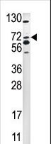 SMURF2 Antibody - Western blot of anti-SMURF2 antibody in 293 cell line lysate (35 ug/lane). SMURF2(arrow) was detected using the purified Pab
