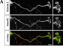 SMURF2 Antibody - Hippocampal neurons were fixed at stage 3, stained with anti-Smurf2 (red) and anti-Kinesin-2 (green) antibodies, and analyzed by confocal microscopy. The panels show single confocal planes. (J. Biol. Chem. 2007 Nov 30;282(48):35259-35268)