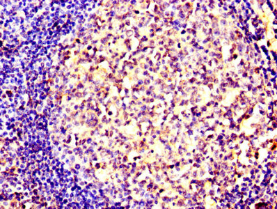 SMURF2 Antibody - Immunohistochemistry of paraffin-embedded human tonsil tissue using SMURF2 Antibody at dilution of 1:100