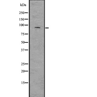 SMURF2 Antibody - Western blot analysis of SMURF2 using Jurkat whole lysates.