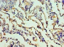 SMYD1 Antibody - Immunohistochemistry of paraffin-embedded human lung tissue using antibody at 1:100 dilution.