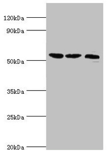 SMYD1 Antibody - Western blot All lanes: Histone-lysine N-methyltransferase SMYD1 antibody at 2µg/ml Lane 1: Mouse heart tissue Lane 2: 293T whole cell lysate Lane 3: Mouse skeletal muscle tissue Secondary Goat polyclonal to rabbit IgG at 1/10000 dilution Predicted band size: 57 kDa Observed band size: 57 kDa