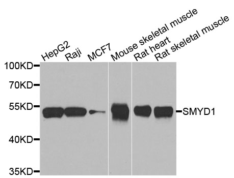 SMYD1 Antibody - Western blot analysis of extracts of various cells.