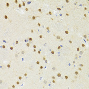 SMYD1 Antibody - Immunohistochemistry of paraffin-embedded rat brain tissue.