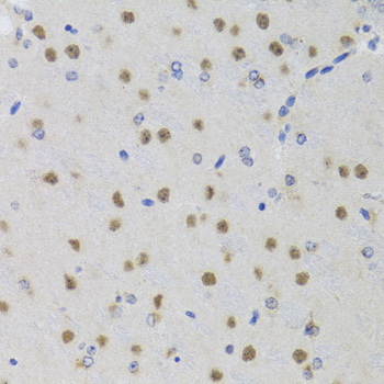 SMYD1 Antibody - Immunohistochemistry of paraffin-embedded mouse brain tissue.