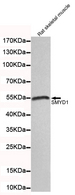 SMYD1 Antibody - Western blot detection of SMYD1 in rat skeletal muscle lysates and using SMYD1 mouse monoclonal antibody (1:100 dilution). Predicted band size: 56KDa. Observed band size: 56KDa.