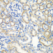 SMYD1 Antibody - Immunohistochemistry of paraffin-embedded rat kidney tissue.