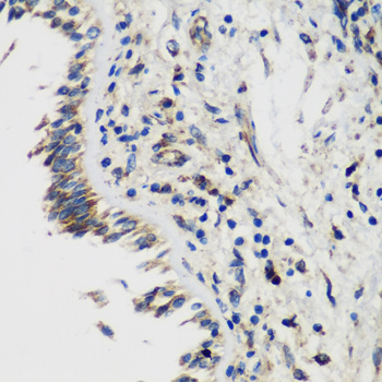SMYD1 Antibody - Immunohistochemistry of paraffin-embedded human lung tissue.