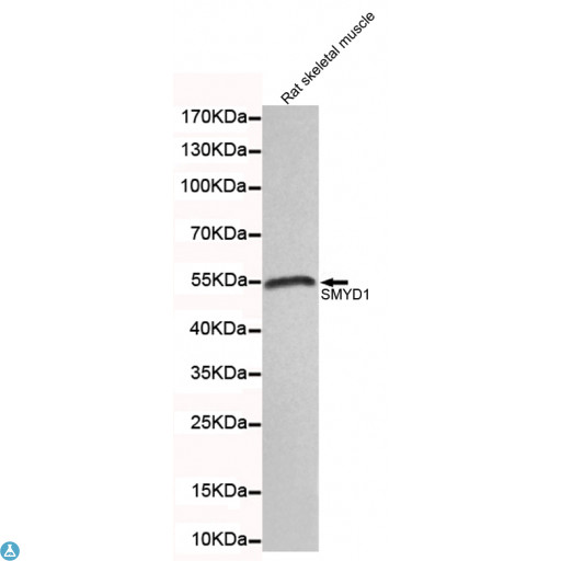 SMYD1 Antibody - Western blot detection of SMYD1 in rat skeletal muscle lysates and using SMYD1 mouse mAb (1:100 diluted). Predicted band size: 56KDa. Observed band size: 56KDa.
