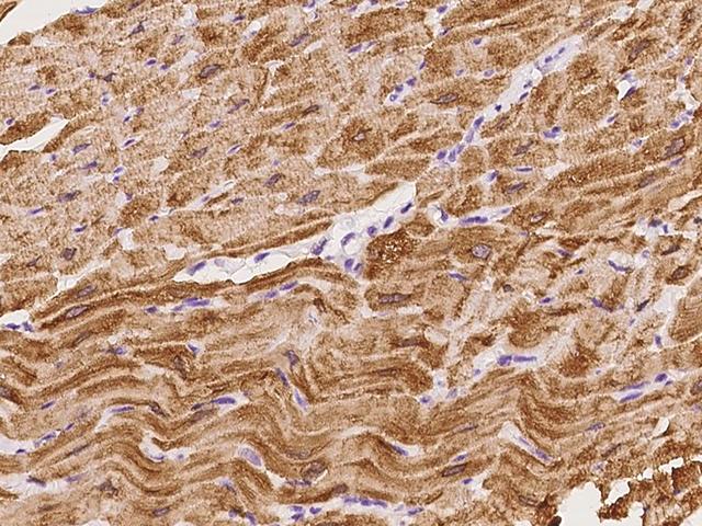 SMYD1 Antibody - Immunochemical staining of human SMYD1 in cynomolgus heart with rabbit polyclonal antibody at 1:100 dilution, formalin-fixed paraffin embedded sections.