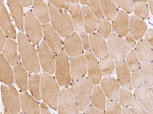 SMYD1 Antibody - Immunochemical staining of human SMYD1 in human skeletal muscle with rabbit polyclonal antibody at 1:100 dilution, formalin-fixed paraffin embedded sections.
