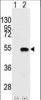 SMYD2 Antibody - Western blot of SYMD2 (arrow) using rabbit polyclonal SYMD2 Antibody. 293 cell lysates (2 ug/lane) either nontransfected (Lane 1) or transiently transfected with the SYMD2 gene (Lane 2) (Origene Technologies).