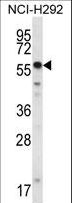 SMYD2 Antibody - SMYD2 Antibody western blot of NCI-H292 cell line lysates (35 ug/lane). The SMYD2 antibody detected the SMYD2 protein (arrow).