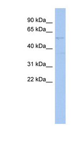 SMYD2 Antibody - SMYD2 antibody Western blot of SH-SYSY lysate. This image was taken for the unconjugated form of this product. Other forms have not been tested.