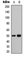 SMYD2 Antibody - Western blot analysis of SMYD2 expression in HEK293T (A); HeLa (B) whole cell lysates.