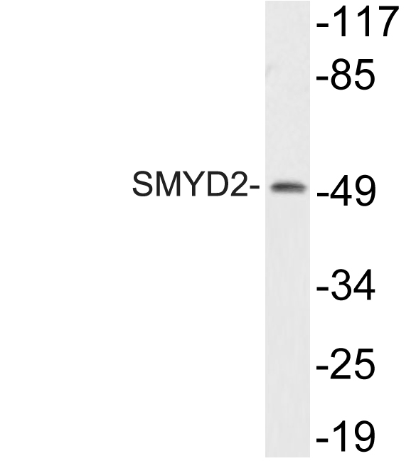 SMYD2 Antibody - Western blot of SMYD2 (L148) pAb in extracts from HT29 cells.