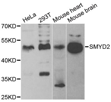 SMYD2 Antibody - Western blot analysis of extracts of various cell lines.