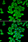 SMYD2 Antibody - Immunofluorescence analysis of HeLa cells.