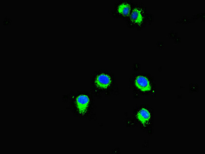 SMYD2 Antibody - Immunofluorescent analysis of Hela cells diluted at 1:100 and Alexa Fluor 488-congugated AffiniPure Goat Anti-Rabbit IgG(H+L)