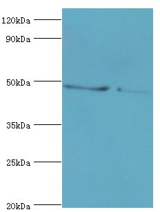 SMYD3 Antibody - Western blot. All lanes: Histone-lysine N-methyltransferase SMYD3 antibody at 3 ug/ml. Lane 1: HeLa whole cell lysate. Lane 2: HepG2 whole cell lysate. secondary Goat polyclonal to rabbit at 1:10000 dilution. Predicted band size: 49 kDa. Observed band size: 49 kDa.
