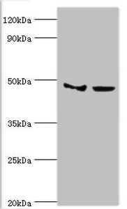 SMYD3 Antibody - Western blot All lanes: Histone-lysine N-methyltransferase SMYD3 antibody at 3µg/ml Lane 1: Hela whole cell lysate Lane 2: HepG2 whole cell lysate Secondary Goat polyclonal to rabbit IgG at 1/10000 dilution Predicted band size: 50, 30, 43 kDa Observed band size: 50 kDa