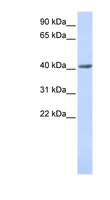 SMYD3 Antibody - SMYD3 antibody Western blot of Fetal Stomach lysate. This image was taken for the unconjugated form of this product. Other forms have not been tested.