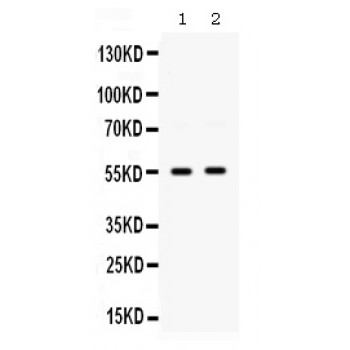 SMYD3 Antibody - Western blot analysis of SMYD3 expression in HELA whole cell lysates (lane 1) and COLO320 whole cell lysates (lane 2). SMYD3 at 55 kD was detected using rabbit anti- SMYD3 Antigen Affinity purified polyclonal antibody at 0.5 ug/mL. The blot was developed using chemiluminescence (ECL) method.