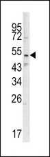SMYD3 Antibody - Western blot of SMYD3 antibody in CEM cell line lysates (35 ug/lane). SMYD3 (arrow) was detected using the purified antibody.