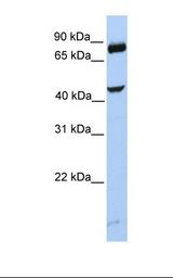 SMYD3 Antibody - MCF7 cell lysate. Antibody concentration: 1.0 ug/ml. Gel concentration: 12%.  This image was taken for the unconjugated form of this product. Other forms have not been tested.
