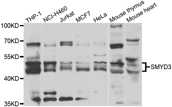 SMYD3 Antibody - Western blot analysis of extracts of various cell lines.
