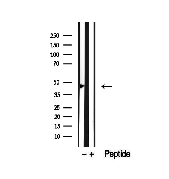 SMYD3 Antibody - Western blot analysis of extracts of HepG2 cells using SMYD3 antibody.