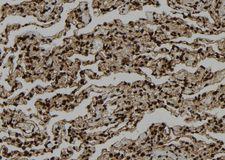 SMYD3 Antibody - 1:100 staining human lung tissue by IHC-P. The sample was formaldehyde fixed and a heat mediated antigen retrieval step in citrate buffer was performed. The sample was then blocked and incubated with the antibody for 1.5 hours at 22°C. An HRP conjugated goat anti-rabbit antibody was used as the secondary.