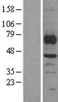 SMYD3 Protein - Western validation with an anti-DDK antibody * L: Control HEK293 lysate R: Over-expression lysate