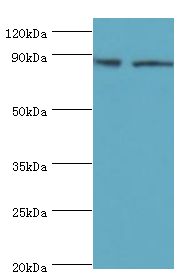 SMYD4 Antibody - Western blot. All lanes: SET and MYND domain-containing protein 4 antibody at 4 ug/ml. Lane 1: HepG2 whole cell lysate. Lane 2: HeLa whole cell lysate. secondary Goat polyclonal to rabbit at 1:10000 dilution. Predicted band size: 89 kDa. Observed band size: 89 kDa.