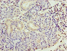 SMYD4 Antibody - Immunohistochemistry of paraffin-embedded human pancreas tissue using antibody at 1:100 dilution.