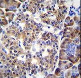 SMYD4 Antibody - SMYD4 Antibody immunohistochemistry of formalin-fixed and paraffin-embedded human pancreas tissue followed by peroxidase-conjugated secondary antibody and DAB staining.