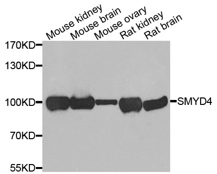 SMYD4 Antibody - Western blot analysis of extracts of various cells.