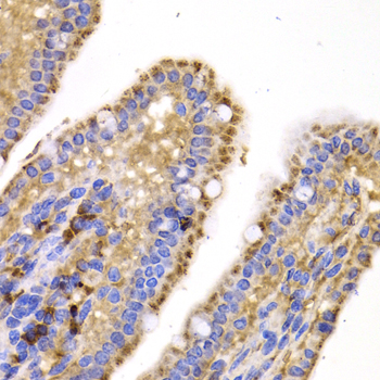 SMYD4 Antibody - Immunohistochemistry of paraffin-embedded mouse jejunum tissue.