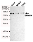 SMYD4 Antibody - Western blot detection of SMYD4 in HeLa, MCF7 and A431 cell lysates using SMYD4 mouse monoclonal antibody (1:200 dilution). Predicted band size: 89KDa. Observed band size:89KDa.