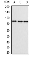 SMYD4 Antibody - Western blot analysis of SMYD4 expression in mouse brain (A); mouse ovary (B); rat kidney (C) whole cell lysates.