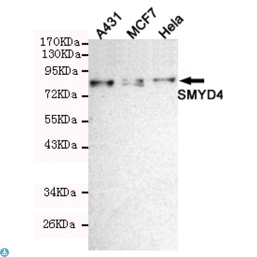 SMYD4 Antibody - Western blot detection of SMYD4 in Hela, MCF7 and A431 cell lysates using SMYD4 mouse mAb (1:200 diluted). Predicted band size: 89KDa. Observed band size: 89KDa.
